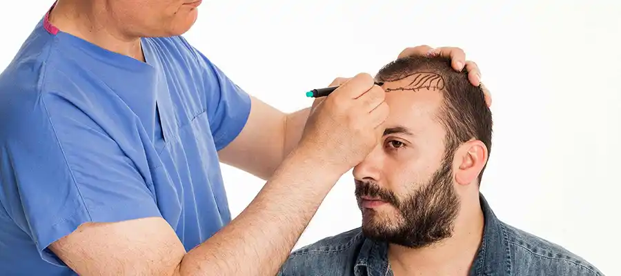 Top 10 des Cliniques de Greffe de Cheveux en Turquie 2026