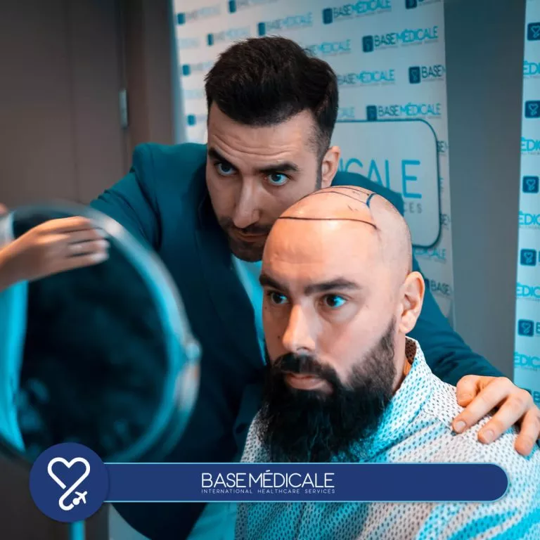 DHI Hair Transplant 2 DHI Hair Transplant