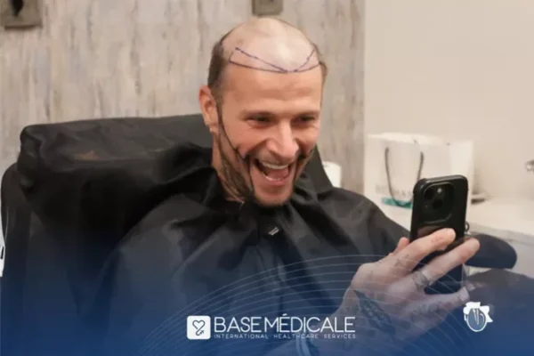 Greffe de Cheveux Turquie Prix