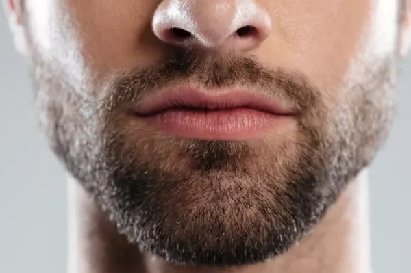 5 Choses à Considérer Avant une Greffe de Barbe