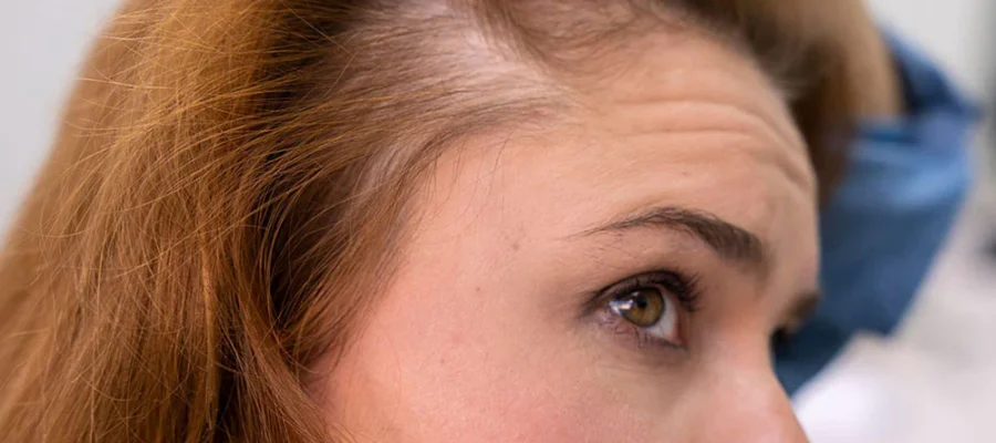 Female Hair Transplant